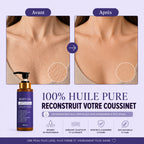 Huile corporelle de luxe pour peau fripée